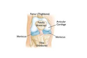 Αρθρίτιδα του γόνατος - Οστεοαρθρίτιδα