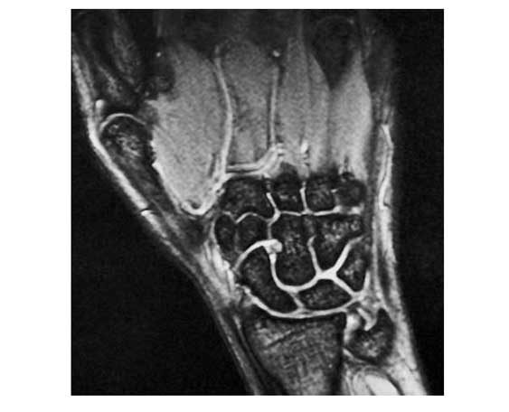 wrist joint