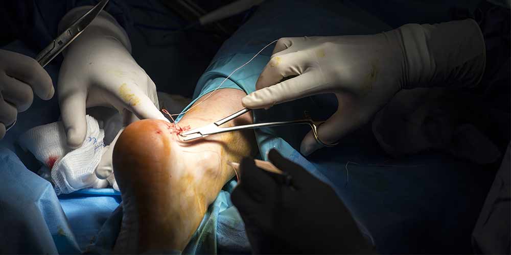 Tendonitis 